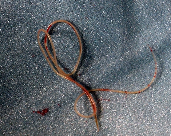 heartworm in dogs symptoms