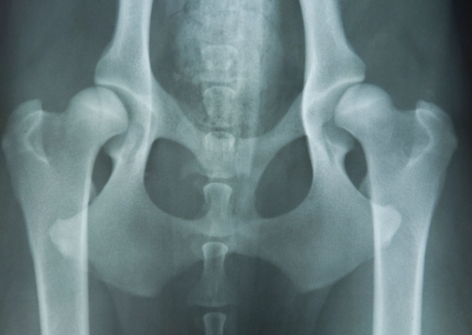 hip dysplasia symptoms